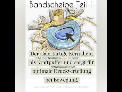 Bandscheibe Quickinfo Teil 1